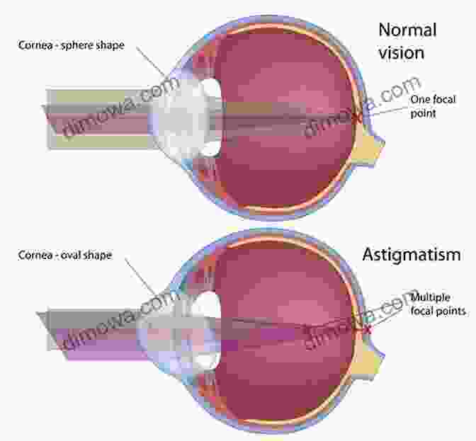 Diagram Illustrating Astigmatism Aberrations And Their Effect On Image Clarity Aberrations Of Optical Systems (Series In Optics And Optoelectronics)